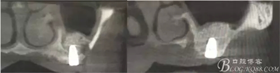 12.webp.jpg 12.webp.jpg