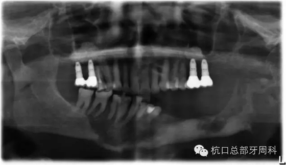 114.webp.jpg 114.webp.jpg