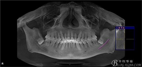 20141021204020_52569.jpg 20141021204020_52569.jpg