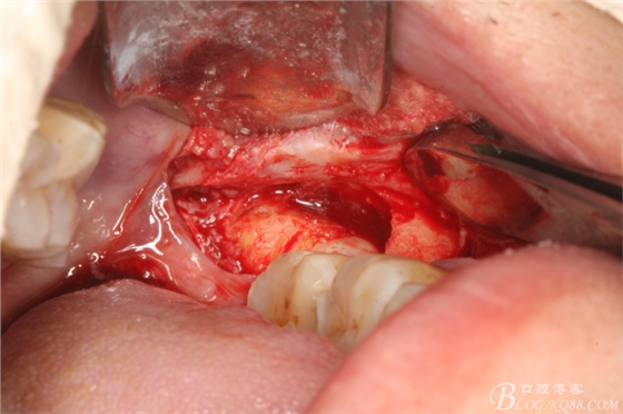 20141021204313_51058.jpg 20141021204313_51058.jpg