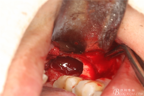 20141021204439_49240.jpg 20141021204439_49240.jpg