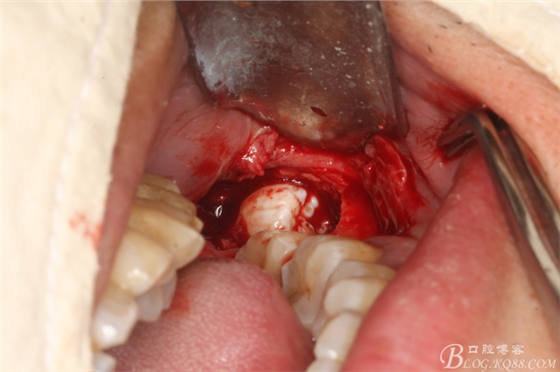 20141021205220_79004.jpg 20141021205220_79004.jpg