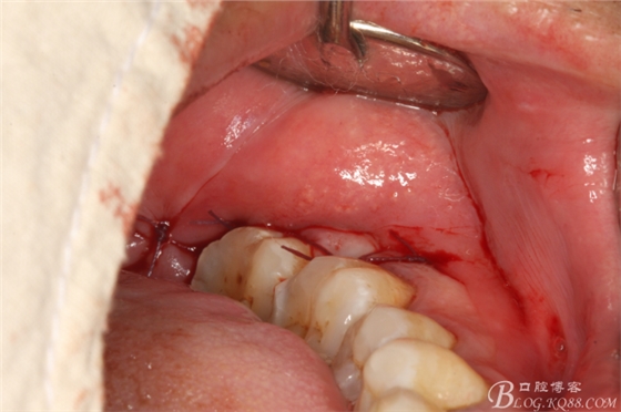 20141021204500_68024.jpg 20141021204500_68024.jpg