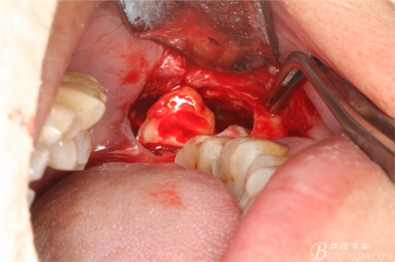 20141021205205_90178.jpg 20141021205205_90178.jpg