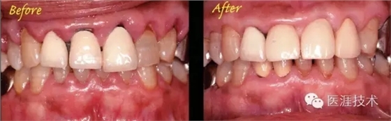 44.webp.jpg 44.webp.jpg