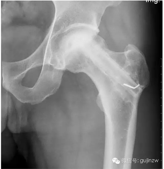 5.webp.jpg 5.webp.jpg