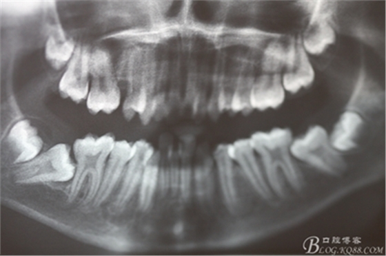 3_副本.jpg 3_副本.jpg