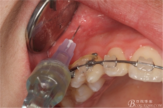 6_副本.jpg 6_副本.jpg