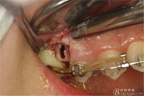 13_副本.jpg 13_副本.jpg