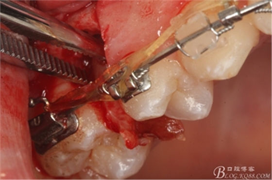 18_副本.jpg 18_副本.jpg