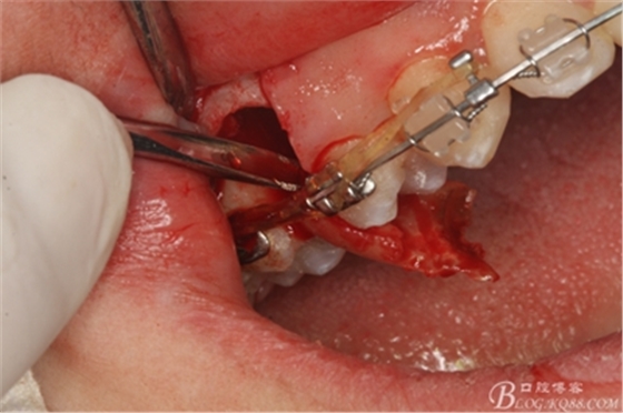 19_副本.jpg 19_副本.jpg