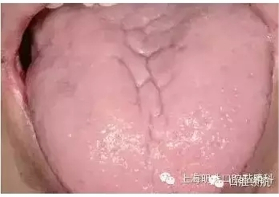 11.webp.jpg 11.webp.jpg