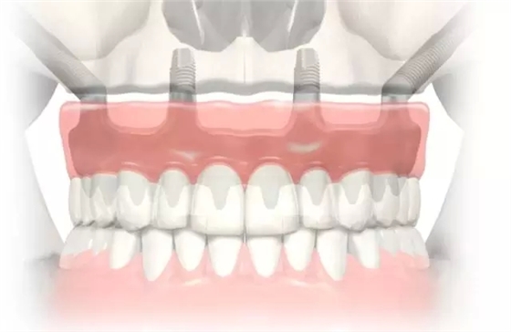 9.webp.jpg 9.webp.jpg