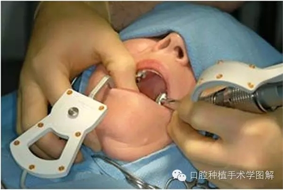 3.webp.jpg 3.webp.jpg