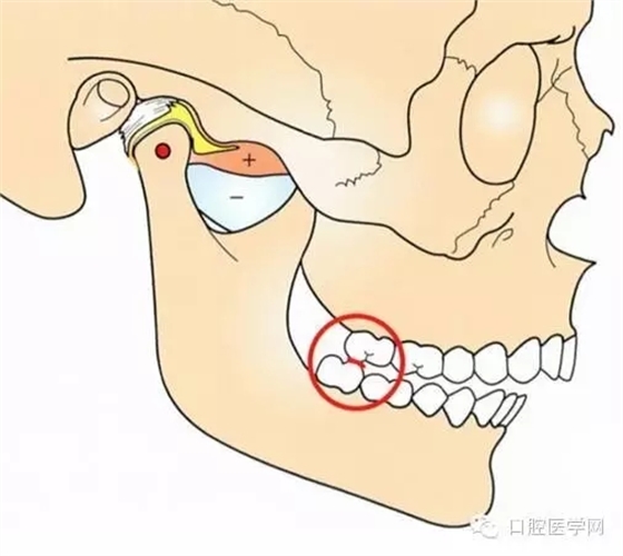 20.webp.jpg 20.webp.jpg