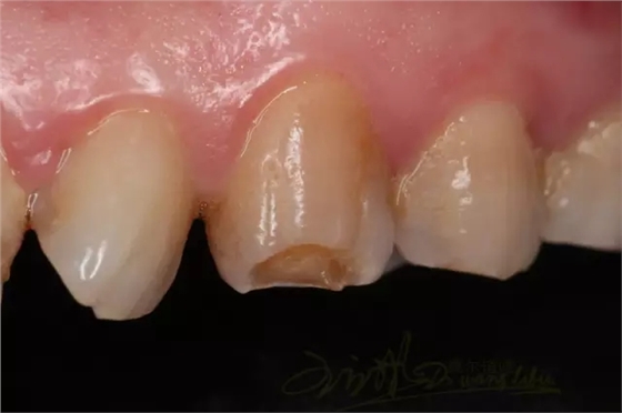 6.webp.jpg 6.webp.jpg