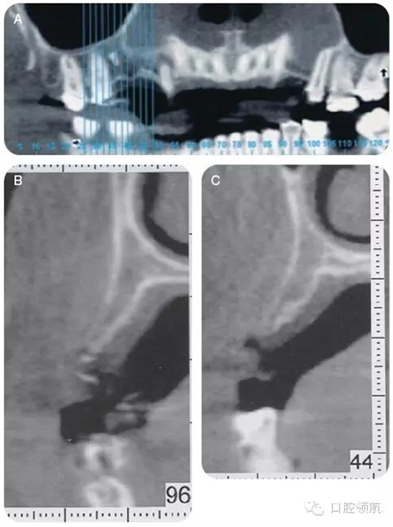 5.webp.jpg 5.webp.jpg