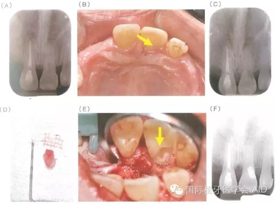 11.webp.jpg 11.webp.jpg