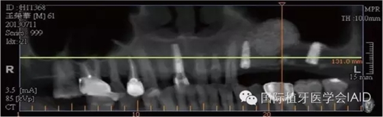 1.webp.jpg 1.webp.jpg