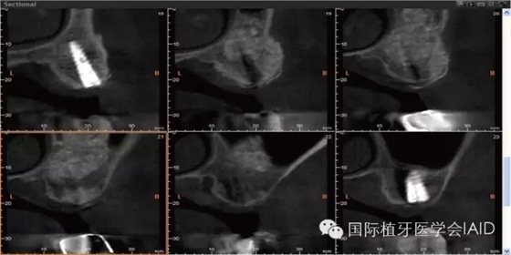 2.webp.jpg 2.webp.jpg