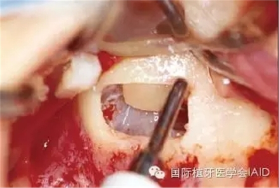 10.webp.jpg 10.webp.jpg