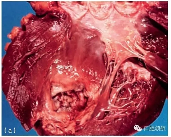 640.webp (9).jpg 640.webp (9).jpg