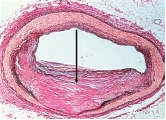 640.webp (2).jpg 640.webp (2).jpg