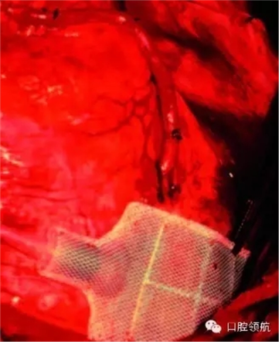 640.webp (4).jpg 640.webp (4).jpg