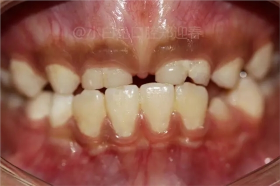 1.webp.jpg 1.webp.jpg