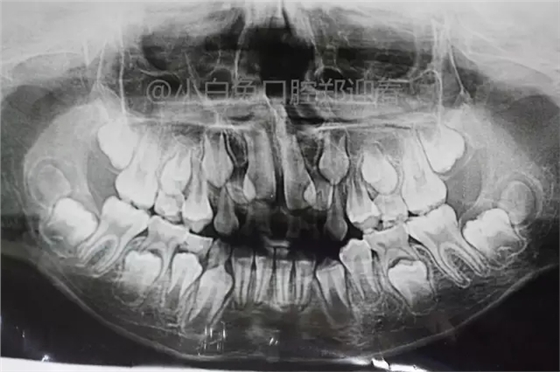 3.webp.jpg 3.webp.jpg