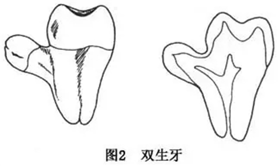 11.webp.jpg 11.webp.jpg