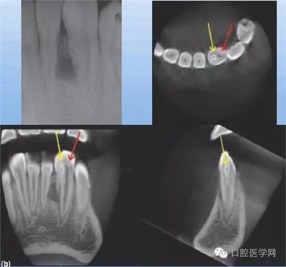 2.webp.jpg 2.webp.jpg