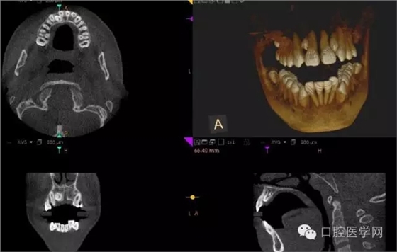 3.webp.jpg 3.webp.jpg