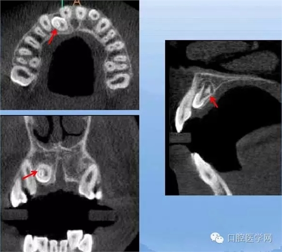 4.webp.jpg 4.webp.jpg
