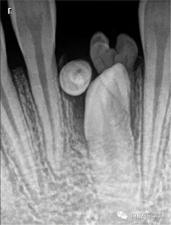 7.webp.jpg 7.webp.jpg