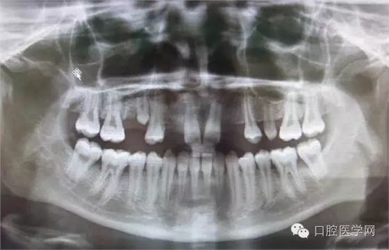 9.webp.jpg 9.webp.jpg