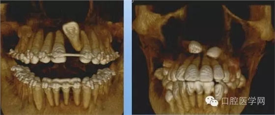 11.webp.jpg 11.webp.jpg