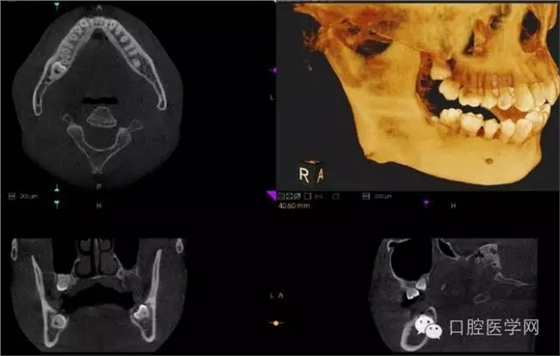 13.webp.jpg 13.webp.jpg