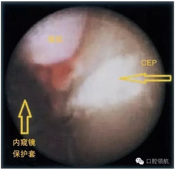 5.webp.jpg 5.webp.jpg