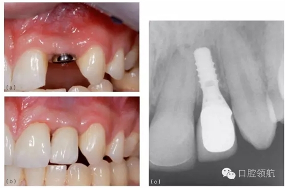 1.webp.jpg 1.webp.jpg