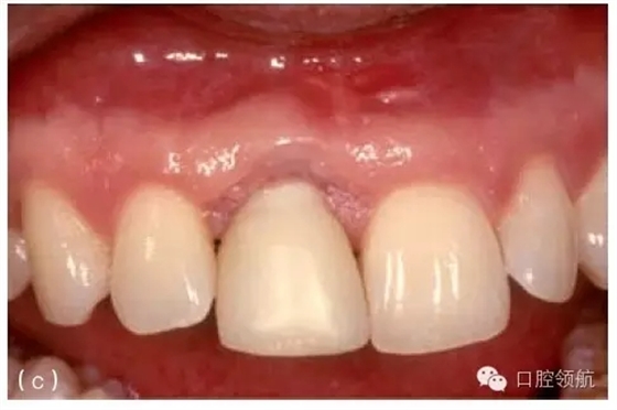 3.webp.jpg 3.webp.jpg