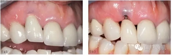 6.webp (1).jpg 6.webp (1).jpg