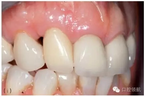 8.webp.jpg 8.webp.jpg