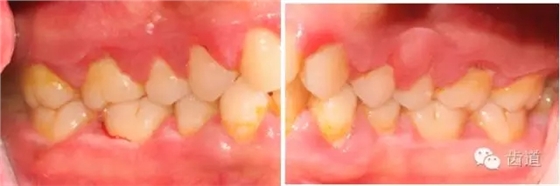 6.webp.jpg 6.webp.jpg