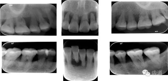 22.webp.jpg 22.webp.jpg