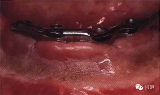 2.webp.jpg 2.webp.jpg