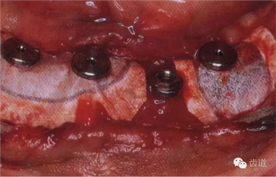 5.webp.jpg 5.webp.jpg