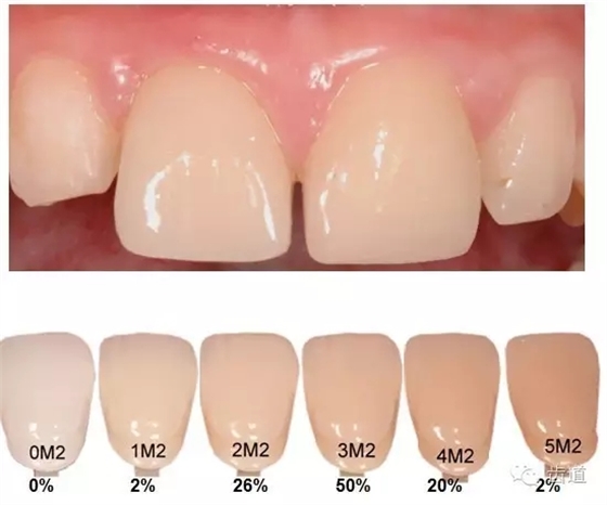 5.webp.jpg 5.webp.jpg