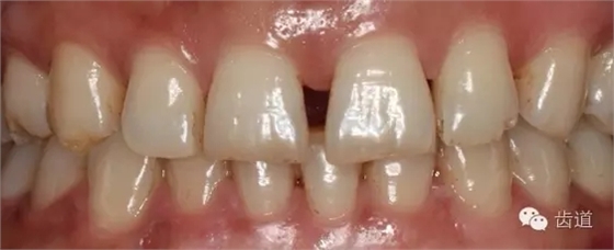 9.webp.jpg 9.webp.jpg