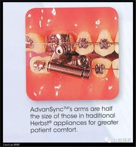 解決牙齒不齊的十八般武器 解決牙齒不齊的十八般武器